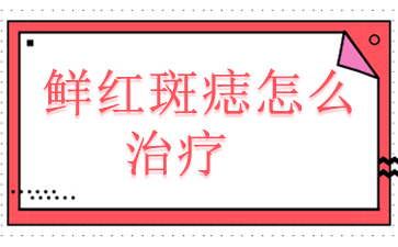 广州鲜红斑痣多少钱-鲜红斑痣怎么治疗