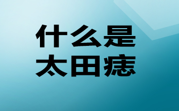 广州治太田痣医院-什么是太田痣