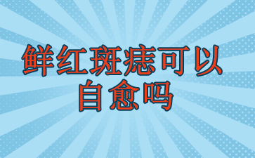 广州治疗鲜红斑痣哪家好-鲜红斑痣可以自愈吗