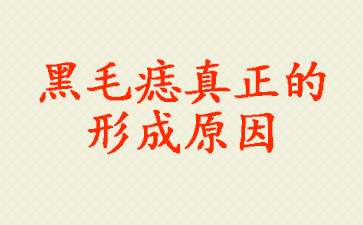 公开_广州看胎记去哪个医院【十强胎记品牌】-黑毛痣真正的形成原因