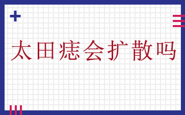 「患者信赖“广州治疗胎记排名”」-太田痣会扩散吗