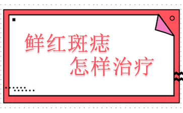 广州鲜红斑痣治疗医院-鲜红斑痣怎样治疗