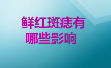 广州鲜红斑痣治疗医院-鲜红斑痣有哪些影响