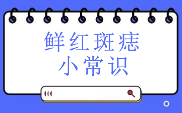 「患者信赖“广州治疗胎记排名”」_鲜红斑痣小常识