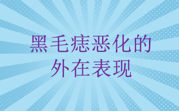 广州去黑毛痣哪家医院好_黑毛痣恶化的外在表现