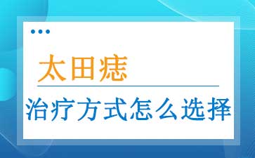 广州胎记治疗哪里好_太田痣一定要治疗吗
