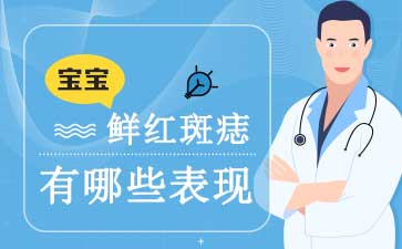 广州哪里治疗胎记_鲜红斑痣的治疗需要多久有效